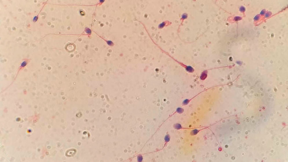 HyperSperm 4